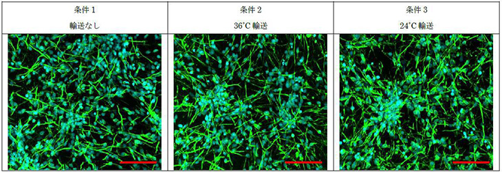 神経細胞の性質 ※タンパク質の発現
